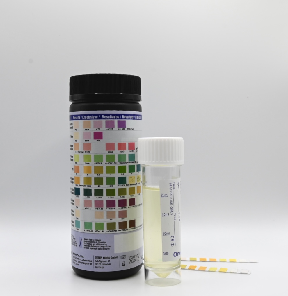 Urinalysis - City Gate Training Centre