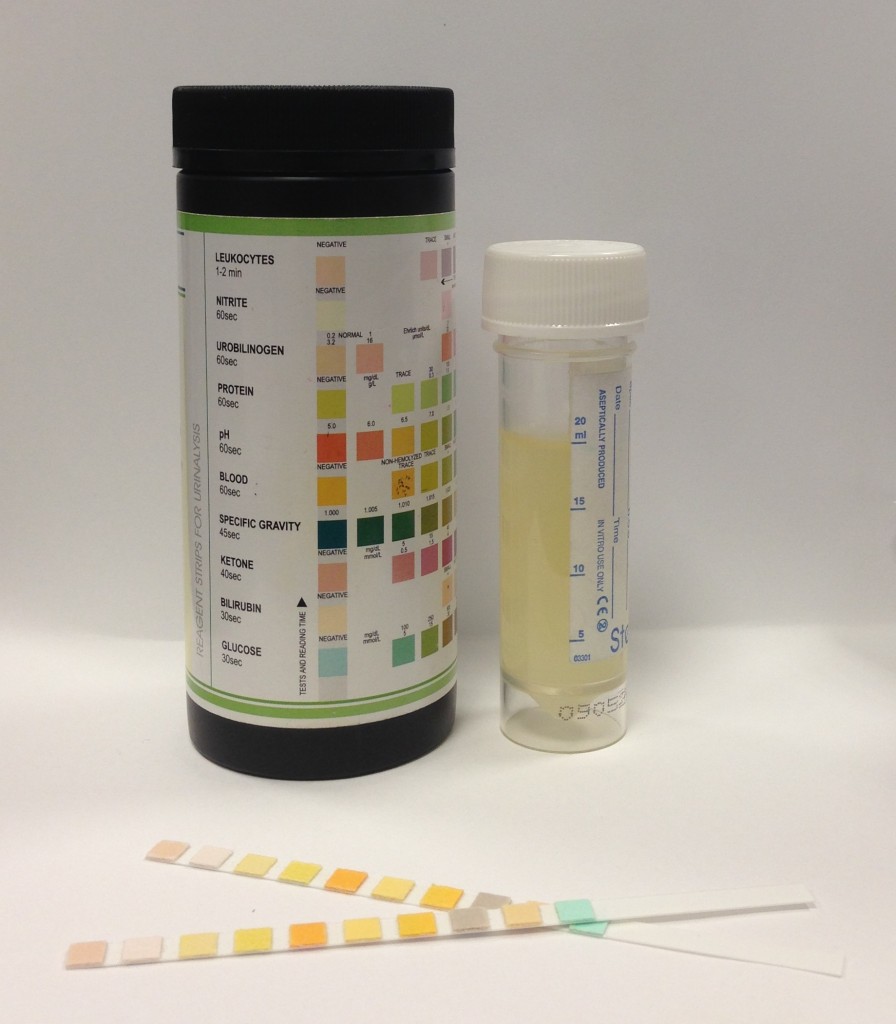 normal-urine-test-strip-results