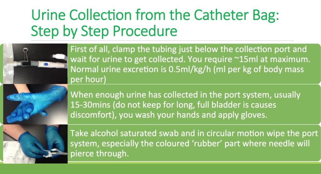 Urine Collection from the catheter bag stepbystep procedure City